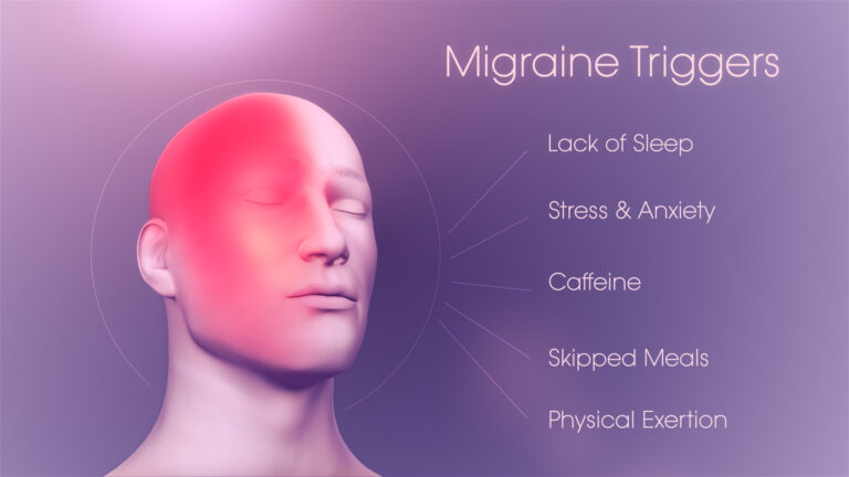 Understanding Migraine