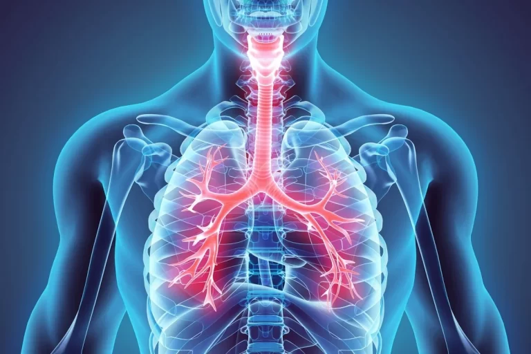 Respiratory Diseases