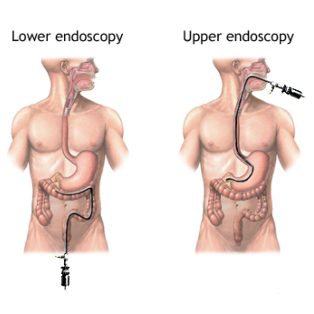 Endoscopy in Nashik